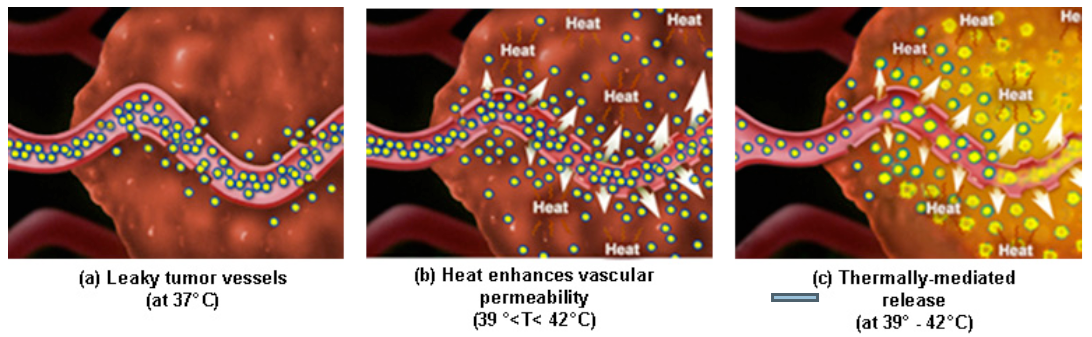 Comparative DOX Delivery Paradigms for Heat Responsive Liposomes